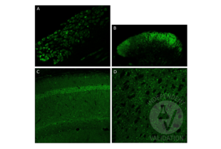 IF staining with ABIN736536 of mouse dorsal root ganglion (DRG, A), the dorsal horn of the spinal cord (B), and the hippocampus CA1 (C) and Putamen (D). 