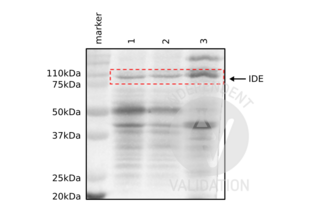 Western blot detection of IDE (110 kDa) in adult mouse brain (1), cerebellum (2), and liver (3) tissue homogenates with ABIN723680.