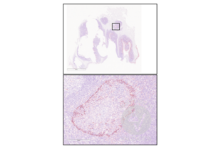 Immunohistochemistry validation image for anti-Interleukin 2 Receptor, alpha (IL2RA) (AA 201-268) antibody (ABIN670371)