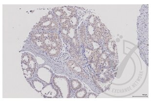 Immunohistochemistry validation image for anti-Mitogen-Activated Protein Kinase Kinase 5 (MAP2K5) (AA 251-350) antibody (ABIN754183)
