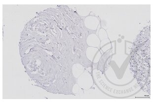 Immunohistochemistry validation image for anti-Mitogen-Activated Protein Kinase Kinase 1 (MAP2K1) (AA 2-150) antibody (ABIN686482)