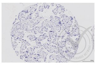 Immunohistochemistry validation image for anti-Mitogen-Activated Protein Kinase Kinase 1 (MAP2K1) (AA 2-150) antibody (ABIN686482)