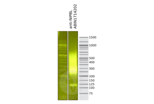 Cleavage Under Targets and Release Using Nuclease validation image for anti-Nipped-B like Protein (NIPBL) (AA 2651-2805) antibody (ABIN1714202)