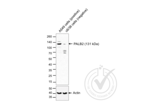 Figure 1. Western blot of lysates from A549 cells (Lane 1) and c6/36 cells (Lane 2) probed with anti-PALB2 (upper panel) or with anti-Actin for loading control (lower panel). 