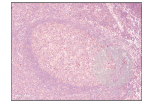 IHC staining of human tonsil with anti-PD-1 antibody ABIN735608 (1:250) and counterstain with hematoxylin.