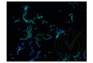 Figure 1: A431 cells stained with anti-RUNX3 (green) and counterstained with DAPI (blue). 