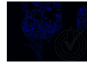 Figure 3: A431 cells stained with isotype control (green) and counterstained with DAPI (blue). 