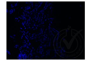Figure 4: A431 cells stained with secondary antibody only (green) and counterstained with DAPI (blue). 