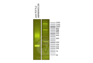 Cleavage Under Targets and Release Using Nuclease validation image for anti-Transcription Factor 7-Like 2 (T-Cell Specific, HMG-Box) (TCF7L2) (AA 1-100) antibody (ABIN6945139)