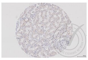 Immunohistochemistry validation image for anti-Wingless-Type MMTV Integration Site Family, Member 2B (WNT2B) (AA 301-391) antibody (ABIN675728)