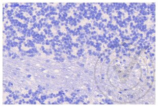 Immunohistochemistry validation image for anti-Clathrin (AA 4-171) antibody (ABIN968006)