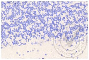 Immunohistochemistry validation image for anti-Clathrin (AA 4-171) antibody (ABIN968006)
