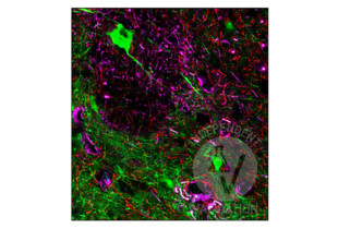 Multiplex Immunohistochemistry validation image for anti-Actin Related Protein 2/3 Complex, Subunit 2, 34kDa (ARPC2) antibody (ABIN2855249)