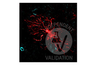 Multiplex Immunohistochemistry validation image for anti-Actin Related Protein 2/3 Complex, Subunit 2, 34kDa (ARPC2) antibody (ABIN2855249)