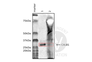 Western Blotting validation image for anti-Calbindin (CALB1) antibody (ABIN3018777) (CALB1 Antikörper)