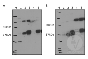 ENTPD5 antibody  (Center)