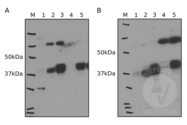 ENTPD5 Antikörper  (Center)