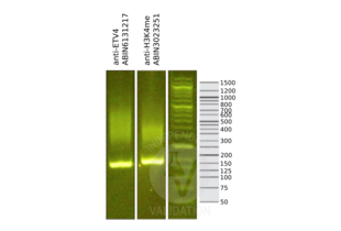 Library profiles comparing fragment size distributions on an E-Gel EX 2% agarose gel (Thermo Fisher). Fragments obtained from CUT&RUN using anti-ETV4 antibody ABIN6131217 and anti-H3K4me antibody ABIN3023251 after library preparation, compared to the E-Gel Sizing DNA Ladder (Thermo Fisher). 