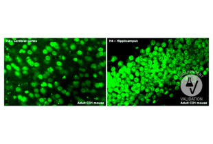 Histone H4 immunoreactive cells in the cerebral cortex and hippocampus of an adult CD1 mouse. Antibody dilution: 1:25. Magnification: 63x.