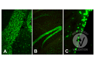 Immunohistochemistry validation image for anti-Histone H4 (3meLys20) antibody (ABIN7260401) (Histone H4 Antikörper  (3meLys20))