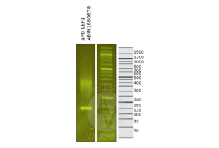 Library profiles comparing fragment size distributions on an E-Gel EX 2% agarose gel (Thermo Fisher). Fragments obtained from CUT&RUN using anti-LEF1 antibody (ABIN1680678) after library preparation, compared to the E-Gel Sizing DNA Ladder (Thermo Fisher). 