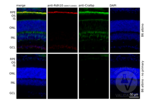 Immunohistochemistry validation image for anti-Retinol Dehydrogenase 10 (All-Trans) (RDH10) antibody (ABIN7118460)
