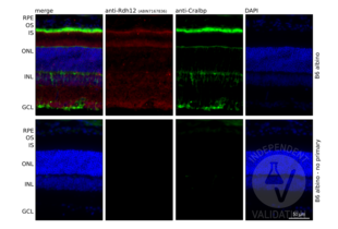 Immunohistochemistry validation image for anti-Retinol Dehydrogenase 12 (All-Trans/9-Cis/11-Cis) (RDH12) (AA 1-316) antibody (ABIN7167836)