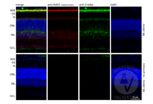 Immunohistochemistry validation image for anti-Retinol Dehydrogenase 5 (11-Cis/9-Cis) (RDH5) antibody (ABIN7254060)