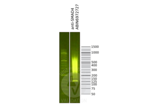 Cleavage Under Targets and Release Using Nuclease validation image for anti-SMAD Family Member 4 (SMAD4) (N-Term) antibody (ABIN6972727)