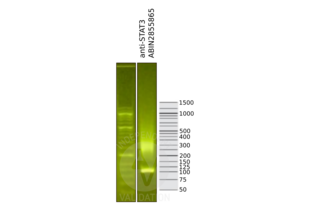 Cleavage Under Targets and Release Using Nuclease validation image for anti-Signal Transducer and Activator of Transcription 3 (Acute-Phase Response Factor) (STAT3) (C-Term) antibody (ABIN2855865)