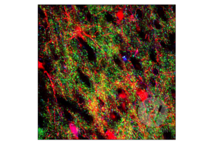 Multiplex Immunohistochemistry validation image for anti-Solute Carrier Family 17 (Vesicular Glutamate Transporter), Member 7 (SLC17A7) (AA 493-560) antibody (ABIN1027710)