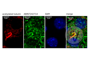 Staining of MIN6 cells with and antibody directed against acetylated tubulin (red, a bona fide marker of the cilium), ABIN7242714 (green) and DAPI (blue). Composite image shows the overlap of red and green staining in the cilium.