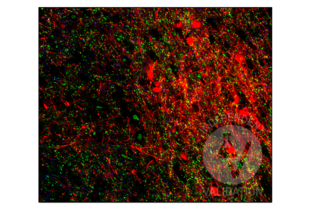 FFPE normal human cortex tissue section labeled with anti-SYN1 antibody ABIN5542390 (blue; bound to fluorophore AF488) after EDTA antigen retrieval. MAP2 and SLC32A1 were labeled with anti-MAP2 antibody ABIN125739 (red; bound to fluorophore ATTO 500) and anti-SLC32A1 antibody ABIN2855225 (green; bound to fluorophore AF488).