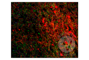 Multiplex Immunohistochemistry validation image for anti-Synapsin I (SYN1) (AA 362-511) antibody (ABIN5542390)