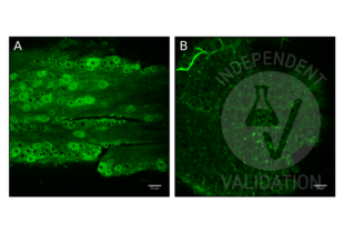 Immunofluorescence validation image for anti-Transient Receptor Potential Cation Channel, Subfamily C, Member 5 (TRPC5) (AA 827-845) antibody (FITC) (ABIN2485379)