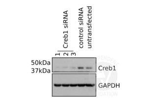Primary mouse microglia were transfected with Creb1 siRNA and Creb1 was revealed using ABIN969061 as described in the protocol section (lanes 1, 2, and 3). Lysates from cells transfected with scrambled siRNA (lane 4) and untransfected cells (lane 5) served as negative controls.