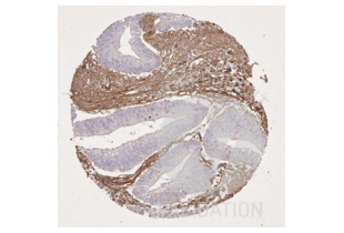 Immunohistochemistry validation image for anti-COL1A2/COL1A1 antibody (ABIN5596819)
