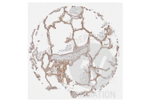 Immunohistochemistry validation image for anti-Collagen, Type IV (COL4) antibody (ABIN5596835)