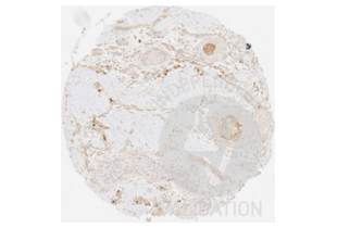 Immunohistochemistry validation image for anti-Collagen, Type III, alpha 1 (COL3A1) antibody (ABIN5596830) (COL3A1 Antikörper)