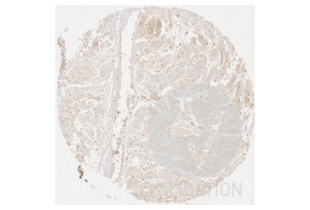 Immunohistochemistry validation image for anti-Collagen, Type III, alpha 1 (COL3A1) antibody (ABIN5596830) (COL3A1 Antikörper)