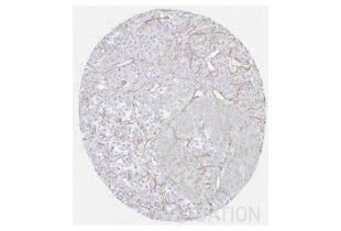 Immunohistochemistry validation image for anti-Collagen, Type IV (COL4) antibody (ABIN5596835) (Collagen IV Antikörper)