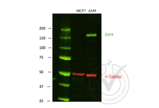 Western Blotting validation image for anti-Epidermal Growth Factor Receptor (EGFR) (C-Term) antibody (ABIN98862) (EGFR Antikörper  (C-Term))