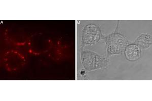 Expression of GABA(A) ?