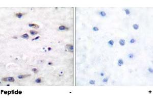 Immunohistochemical analysis of paraffin-embedded human brain tissue using GRIA1 polyclonal antibody . (Glutamate Receptor 1 Antikörper)
