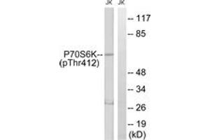 Western blot analysis of extracts from Jurkat cells treated with Insulin 0. (RPS6KB1 Antikörper  (pThr412))