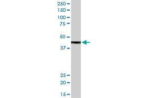 CPB1 MaxPab rabbit polyclonal antibody. (CPB1 Antikörper  (AA 1-417))