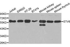 Western blot analysis of extracts of various cell lines, using ETV6 antibody. (ETV6 Antikörper  (AA 1-300))