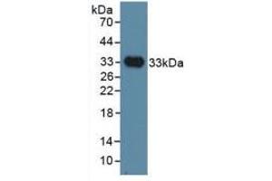 Western blot analysis of recombinant Human INHBP. (IGSF1 Antikörper  (AA 1008-1227))