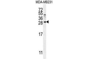 BTC Antibody (N-term) western blot analysis in MDA-MB231 cell line lysates (35µg/lane).