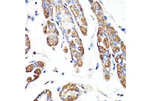Immunohistochemistry of paraffin-embedded human stomach using RNF149 antibody (ABIN7270062) at dilution of 1:100 (40x lens). (RNF149 Antikörper  (AA 221-400))